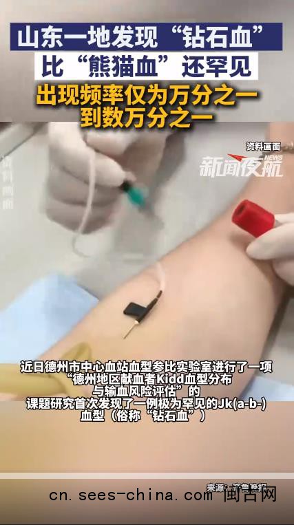 山东发现1例钻石血 比熊猫血更罕见
