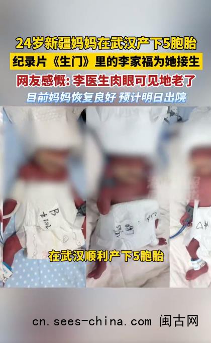 为5胞胎接生的专家肉眼可见地老了