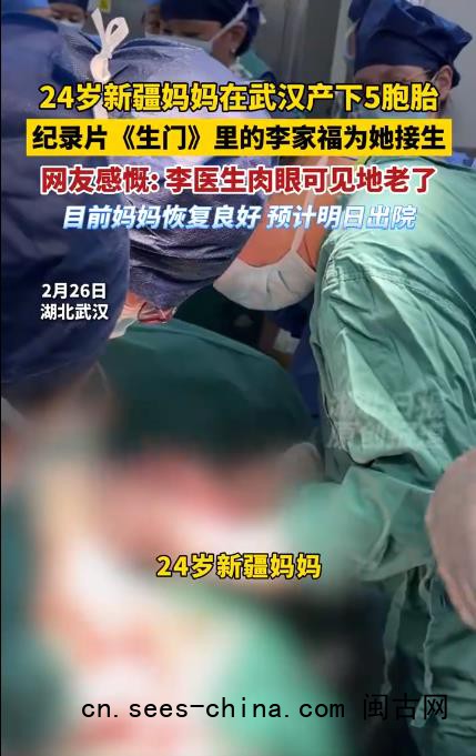 为5胞胎接生的专家肉眼可见地老了