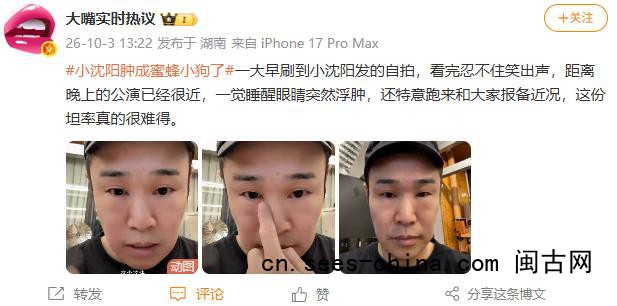 小沈阳一觉睡醒眼睛肿成蜜蜂小狗