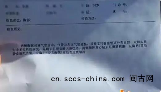 丈夫1个拥抱 妻子断了5根肋骨